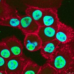PD2 (PAF1), Mouse anti-Human, Clone: F169-3B2, Millipore Sigma 100&mu;g;